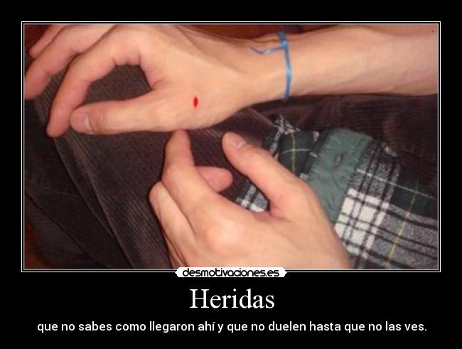 Heridas -