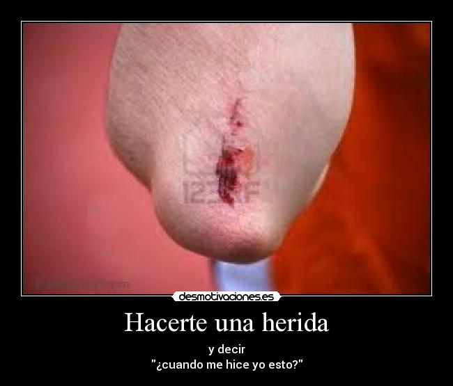 Hacerte una herida - y decir
¿cuando me hice yo esto?