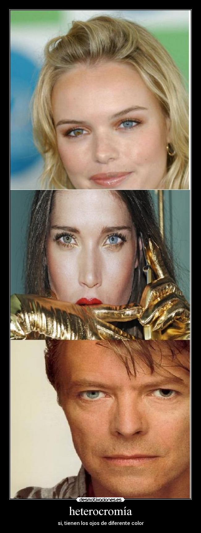heterocromía -