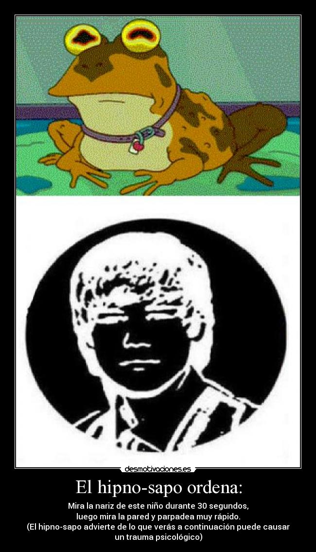 El hipno-sapo ordena: - Mira la nariz de este niño durante 30 segundos,
luego mira la pared y parpadea muy rápido.
(El hipno-sapo advierte de lo que verás a continuación puede causar
un trauma psicológico)