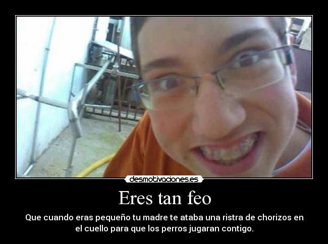 Eres tan feo - Que cuando eras pequeño tu madre te ataba una ristra de chorizos en
el cuello para que los perros jugaran contigo.