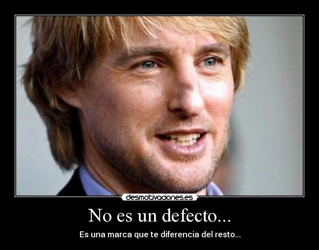 No es un defecto... - Es una marca que te diferencia del resto...