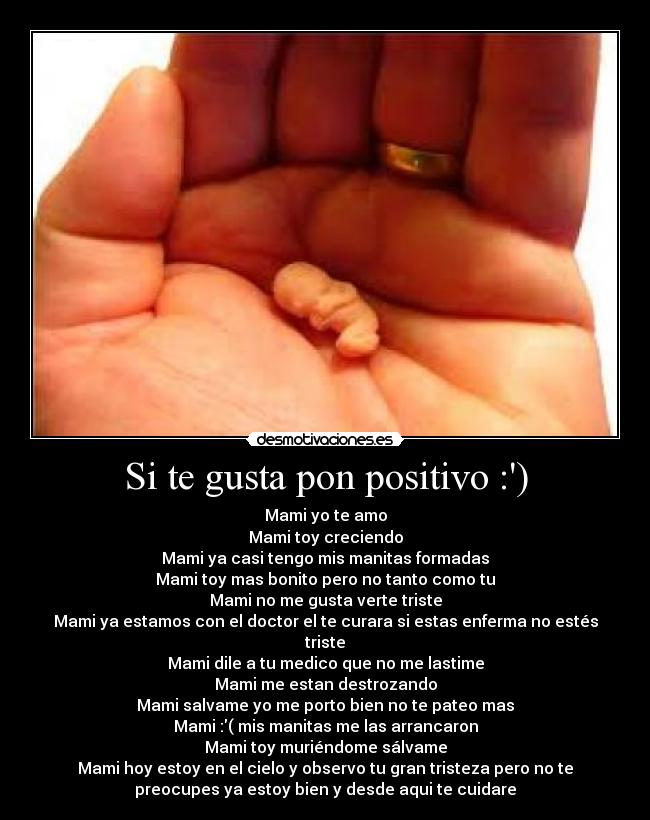 Si te gusta pon positivo :) -