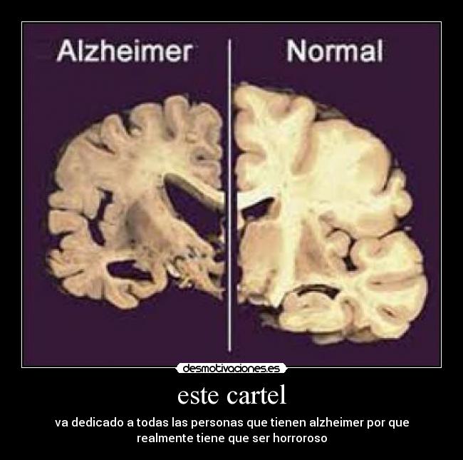 este cartel - va dedicado a todas las personas que tienen alzheimer por que
realmente tiene que ser horroroso