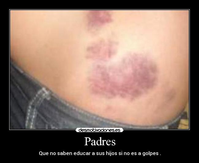 Padres - Que no saben educar a sus hijos si no es a golpes .