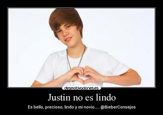 Justin no es lindo -