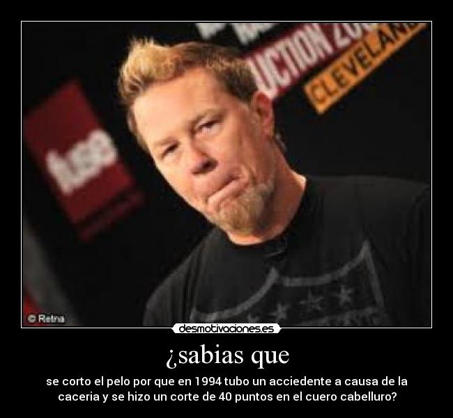 ¿sabias que - se corto el pelo por que en 1994 tubo un acciedente a causa de la
caceria y se hizo un corte de 40 puntos en el cuero cabelluro?