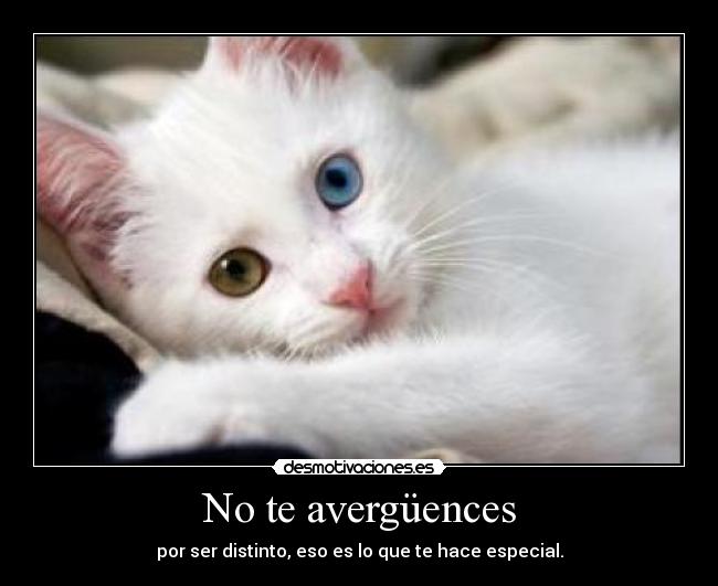 No te avergüences - por ser distinto, eso es lo que te hace especial.