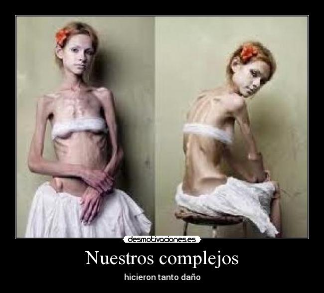 Nuestros complejos -