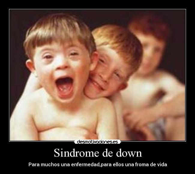 carteles sindrome down desmotivaciones