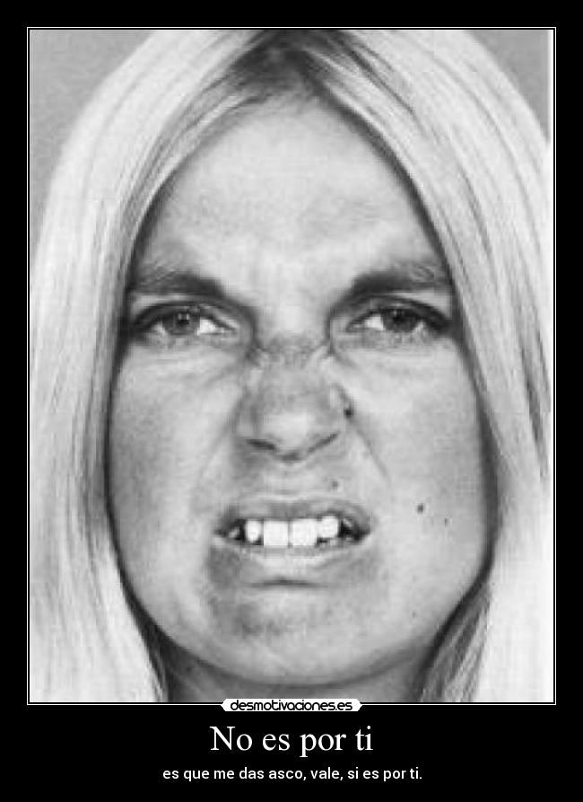 No es por ti - es que me das asco, vale, si es por ti.