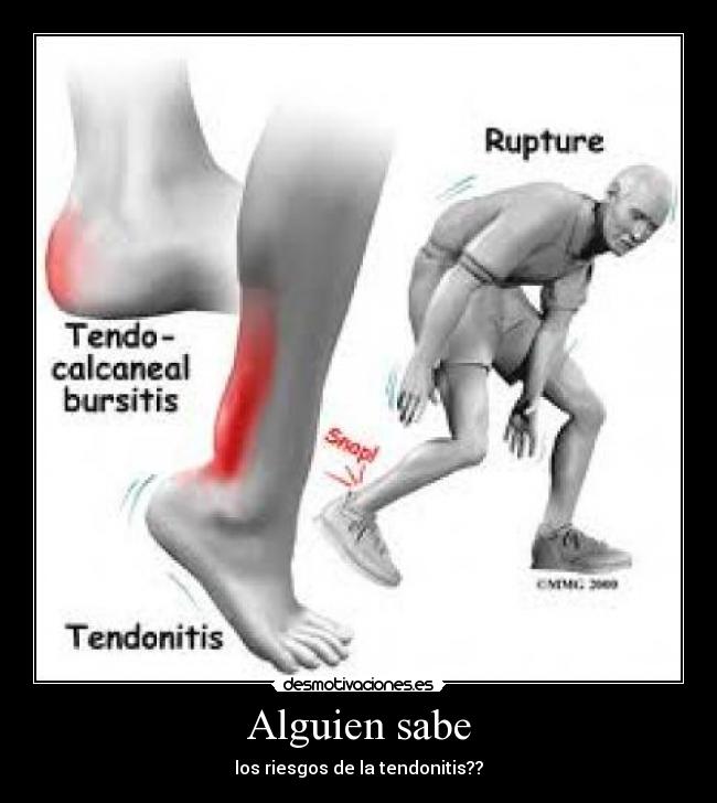 Alguien sabe -