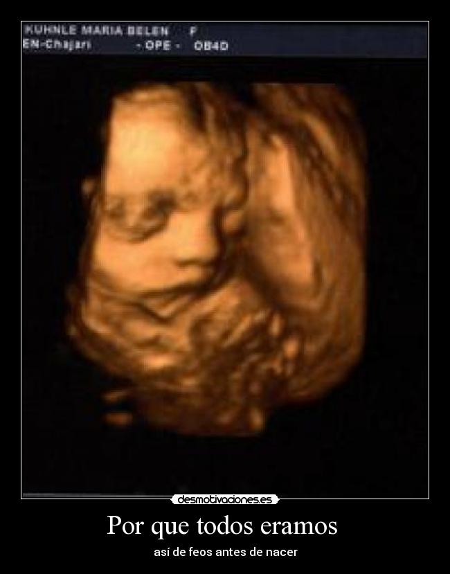 Por que todos eramos  - así de feos antes de nacer