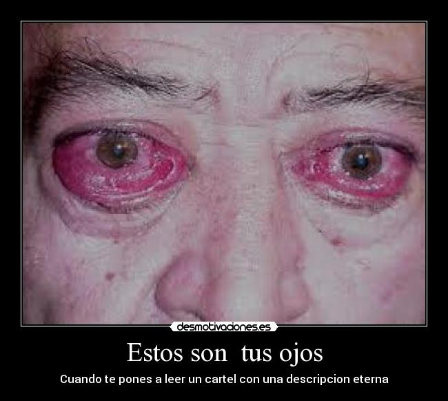 Estos son tus ojos -