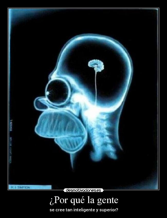 ¿Por qué la gente -