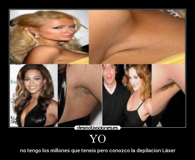 YO - no tengo los millones que teneis pero conozco la depilacion Láser