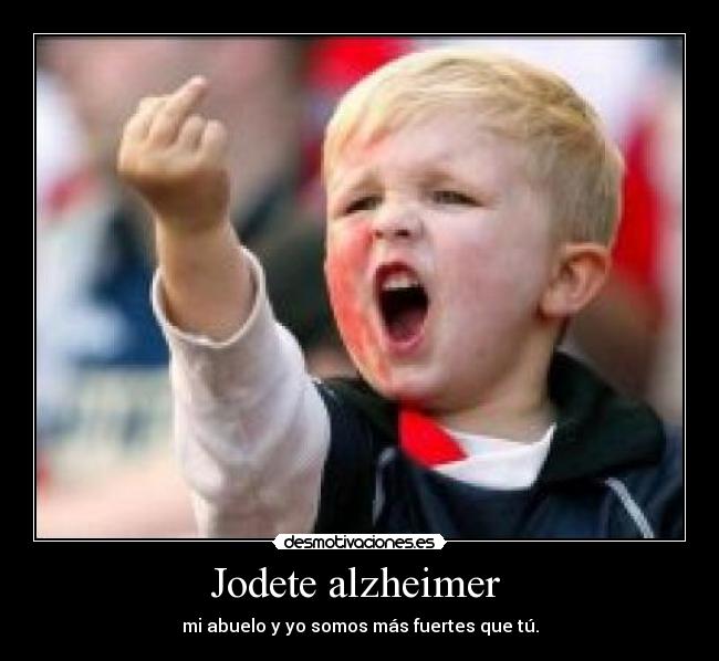 Jodete alzheimer  - 