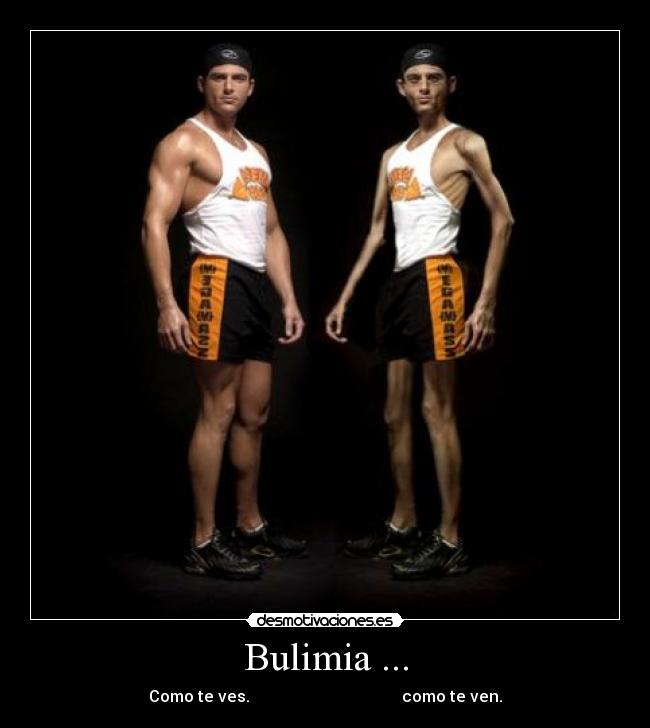 Bulimia ... -