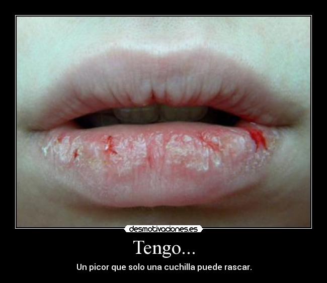 Tengo... - Un picor que solo una cuchilla puede rascar.