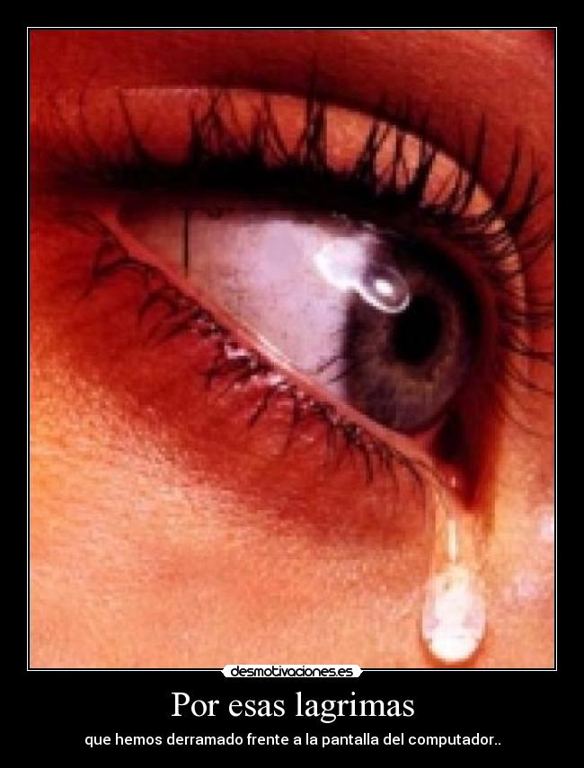 Por esas lagrimas -