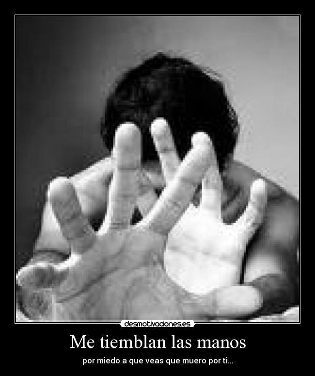 Me tiemblan las manos -