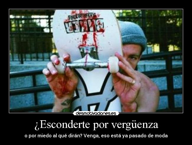 ¿Esconderte por vergüenza - o por miedo al qué dirán? Venga, eso está ya pasado de moda