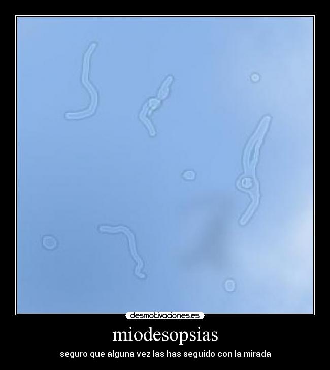 miodesopsias - seguro que alguna vez las has seguido con la mirada