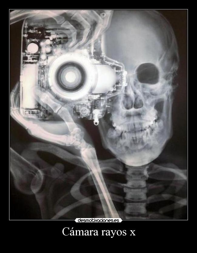 Cámara rayos x - 