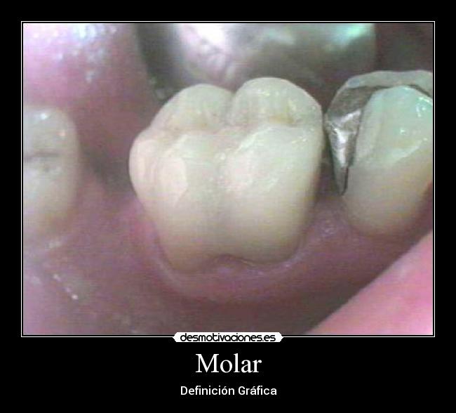 Molar -
