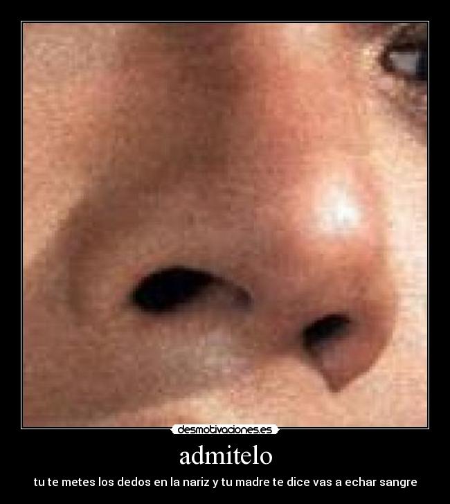 admitelo - tu te metes los dedos en la nariz y tu madre te dice vas a echar sangre