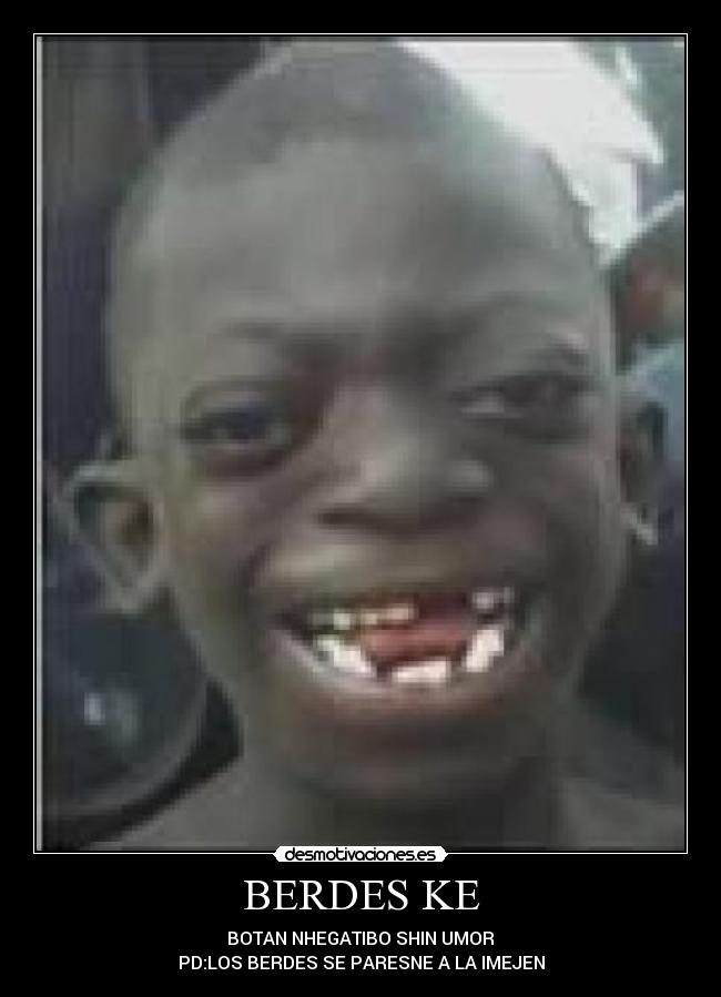 BERDES KE - BOTAN NHEGATIBO SHIN UMOR
PD:LOS BERDES SE PARESNE A LA IMEJEN