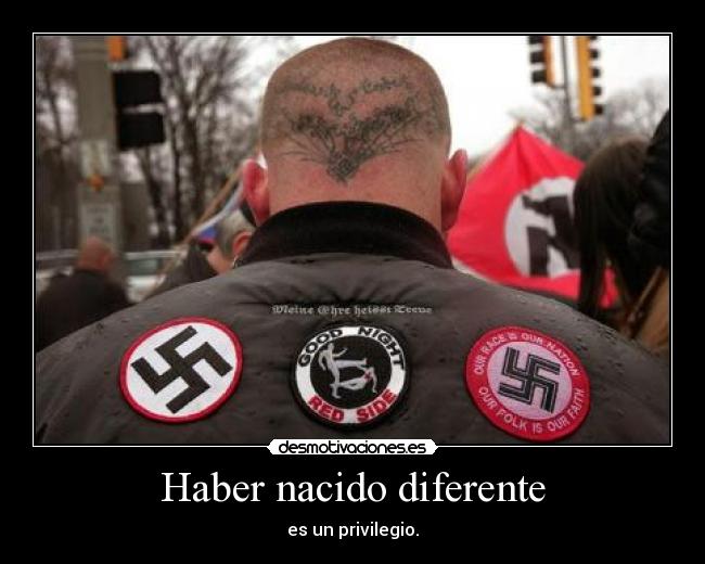 Haber nacido diferente - es un privilegio.