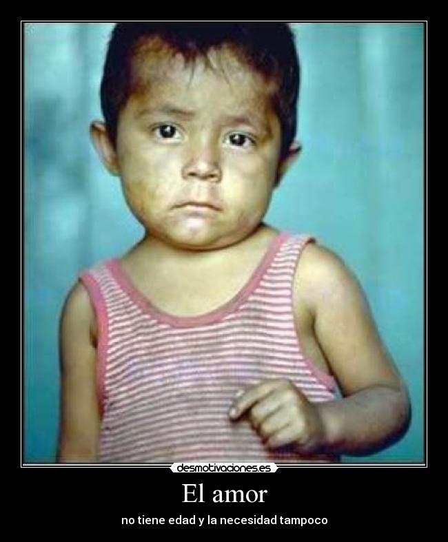 El amor - no tiene edad y la necesidad tampoco