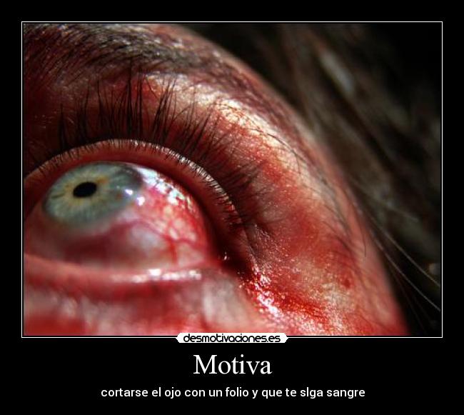 Motiva - cortarse el ojo con un folio y que te slga sangre
