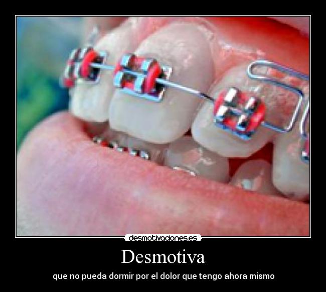 Desmotiva -