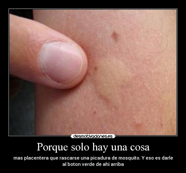 Porque solo hay una cosa - mas placentera que rascarse una picadura de mosquito. Y eso es darle
al boton verde de ahi arriba