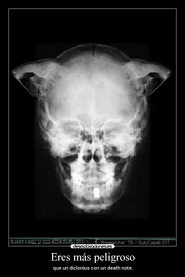 Eres más peligroso - que un diclonius con un death note.