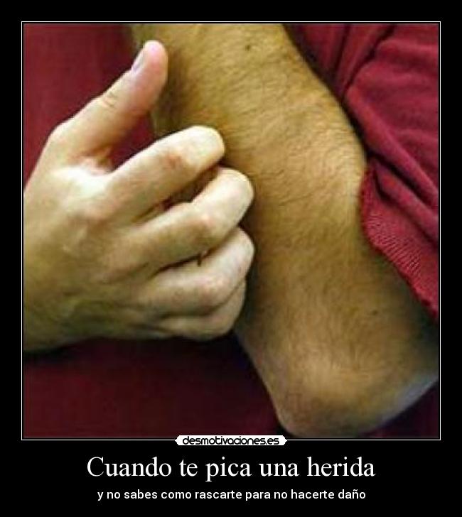 Cuando te pica una herida -