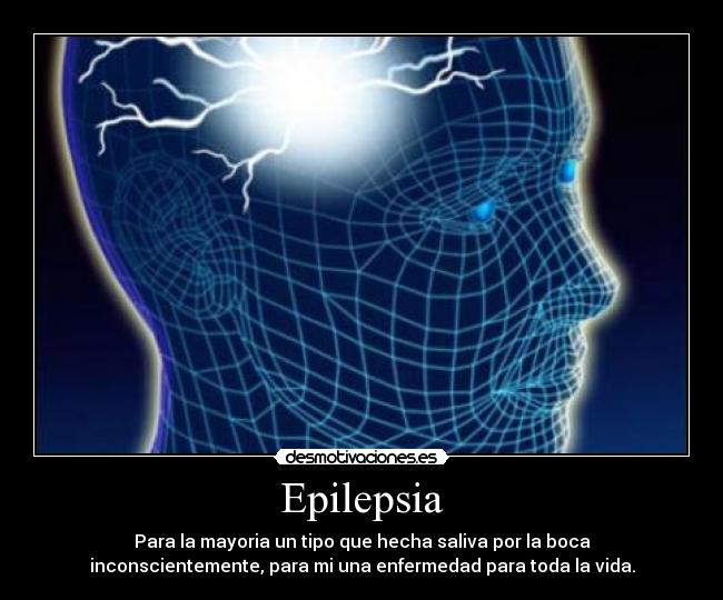 Epilepsia - 