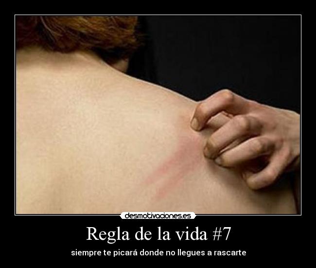Regla de la vida #7 - siempre te picará donde no llegues a rascarte