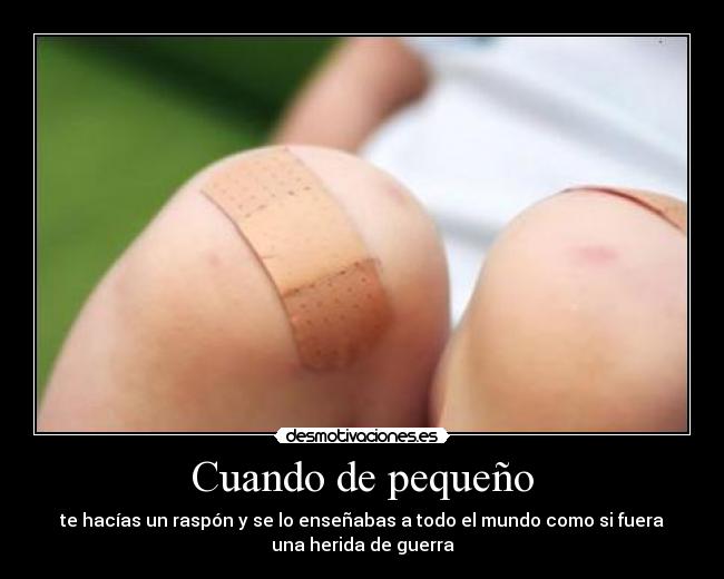 Cuando de pequeño - te hacías un raspón y se lo enseñabas a todo el mundo como si fuera
una herida de guerra