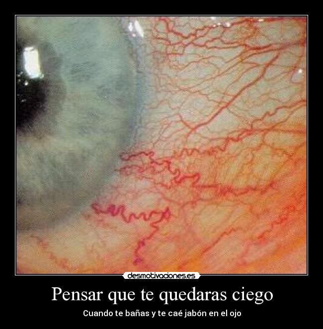 Pensar que te quedaras ciego - Cuando te bañas y te caé jabón en el ojo