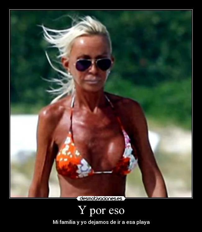 carteles senora flaca inplantes desmotivaciones