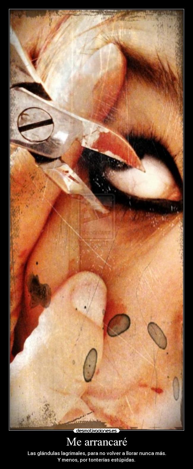 Me arrancaré -