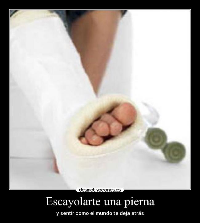 Escayolarte una pierna - y sentir como el mundo te deja atrás