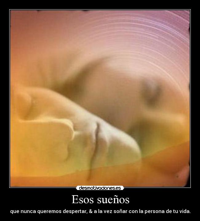 Esos sueños -
