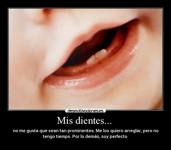 Mis dientes...  - no me gusta que sean tan prominentes. Me los quiero arreglar, pero no
tengo tiempo. Por lo demás, soy perfecto 

