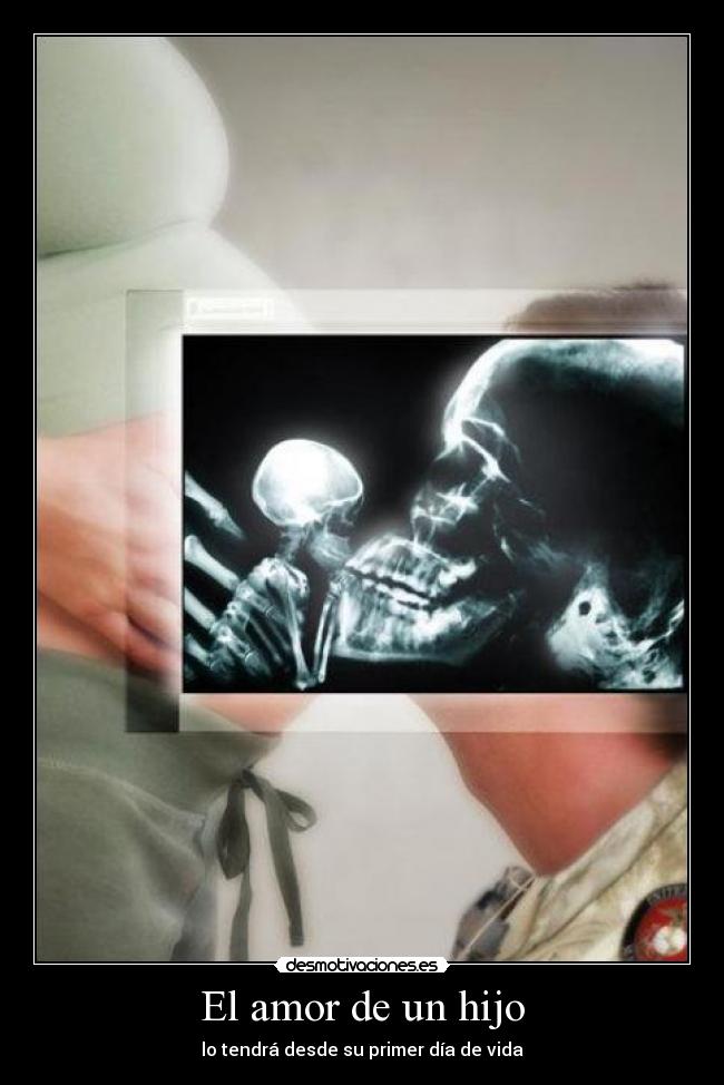 El amor de un hijo -