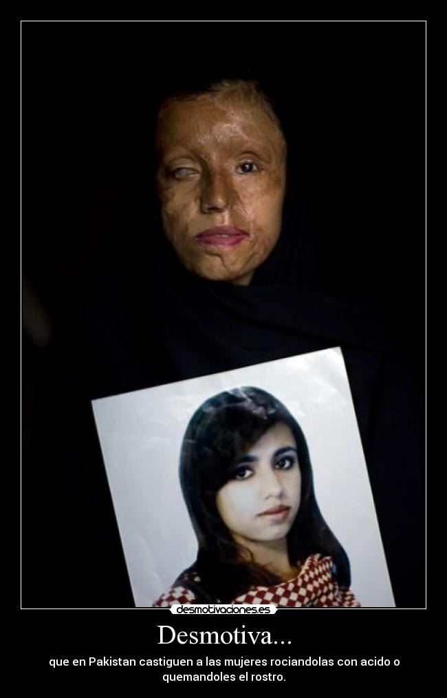 Desmotiva... - que en Pakistan castiguen a las mujeres rociandolas con acido o
quemandoles el rostro.