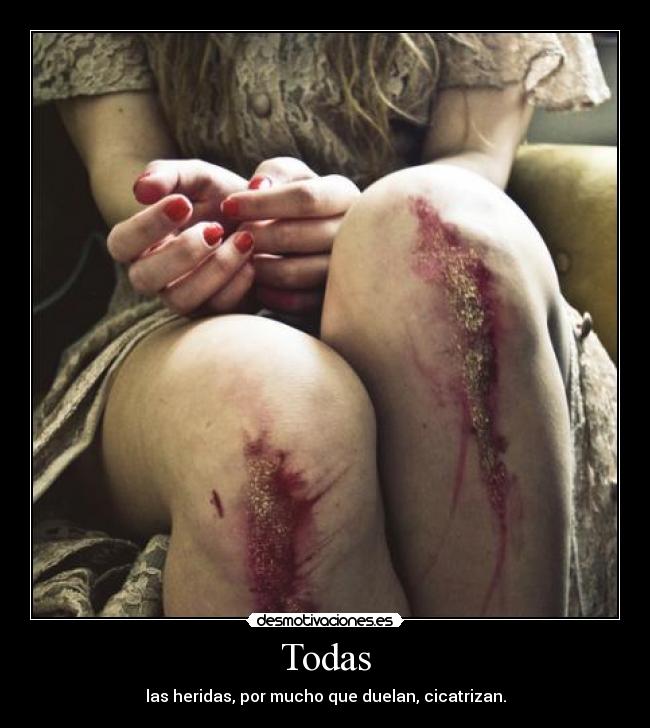 Todas - 